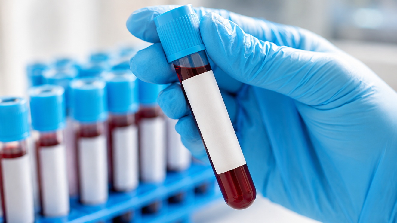 Brain Fog Fix: 7 Proven Strategies To Think Clearly Again 4 Close-Up Of A Blue-Gloved Hand Holding A Blood Sample Test Tube In A Clinical Laboratory, Illustrating Blood Exams For Iron Levels And Thyroid Testing, With Multiple Blurred Collection Tubes In The Background.